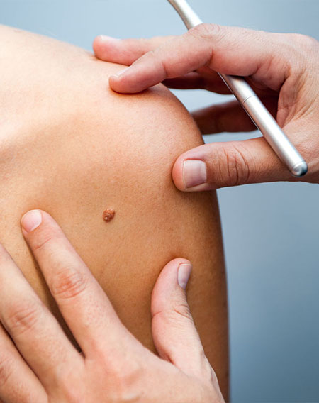 dermatologie